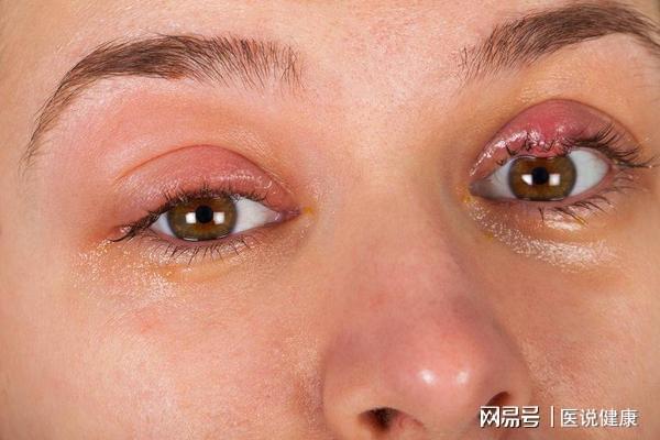 人为恶意窃取数据_cctv美国安局在视窗8植入恶意软件窃取机密_窃取机密罪