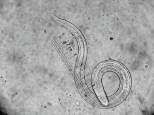体内寄生虫下载,探索异星求生之旅——体内寄生虫游戏电脑版下载指南